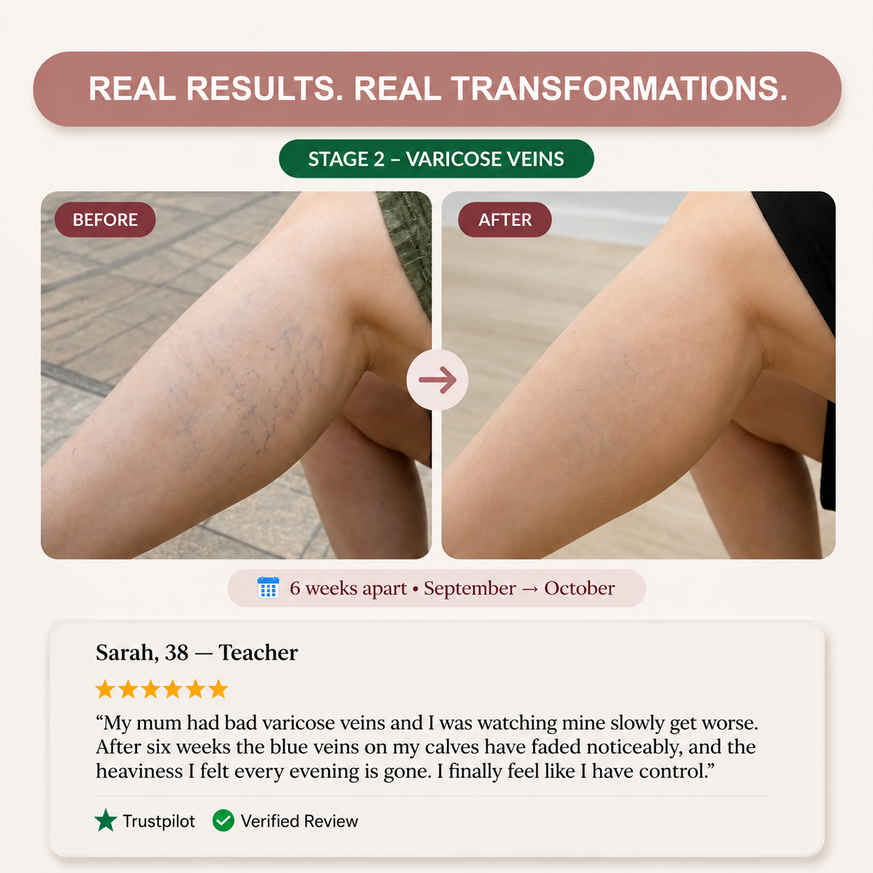 Varicose Vein 3D Compression Legging